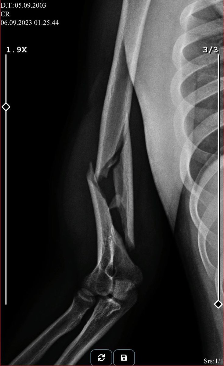 Anılım humerusu kırmış kedimiz doğum yapıyor allam nasıl bi gün