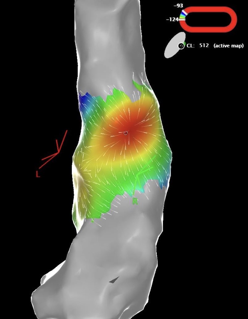 You can’t beat a bit of bully! 🎯 

RVOT mapping by Jim Bowen, sorry I mean <a href="/FeatonbyLuke/">Luke Featonby</a>
