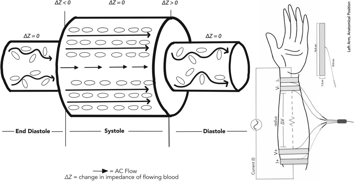 Heart go thump. 
Blood go whooosh. 
TREV go "aha!" (even in fMRI environment)
🧵 on our new paper just out in Psychophysiology! 👇