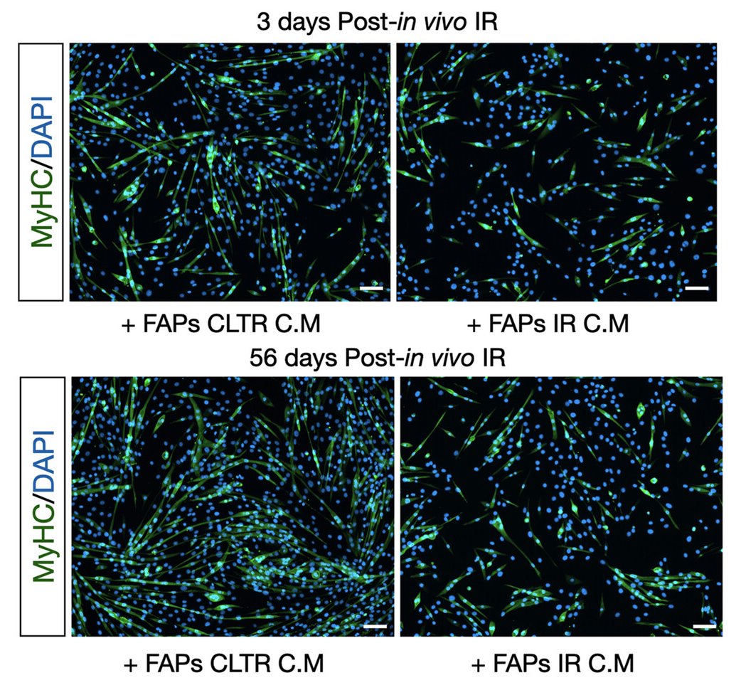 Muscle Cell News (@musclecellnews) on Twitter photo Shout to Drs. <a href="/NicoCollaoA/">Nicolás Collao</a>, <a href="/mike_delisio/">Mike De Lisio</a>, and collaborators including Drs. Keir Menzies (<a href="/Menzies_Lab/">Keir Joe Menzies</a>) and <a href="/yan_burelle/">Yan Burelle</a> on their recent publication! 🙌 🎉 <a href="/uOttawaHealthSc/">uOttawa Sciences de la santé | Health Sciences</a>
Find it #OpenAccess in <a href="/JCSM_cachexia/">Journal of Cachexia, Sarcopenia and Muscle</a>! 👇 Shout to Drs. <a href="/NicoCollaoA/">Nicolás Collao</a>, <a href="/mike_delisio/">Mike De Lisio</a>, and collaborators including Drs. Keir Menzies (<a href="/Menzies_Lab/">Keir Joe Menzies</a>) and <a href="/yan_burelle/">Yan Burelle</a> on their recent publication! 🙌 🎉 <a href="/uOttawaHealthSc/">uOttawa Sciences de la santé | Health Sciences</a>
Find it #OpenAccess in <a href="/JCSM_cachexia/">Journal of Cachexia, Sarcopenia and Muscle</a>! 👇