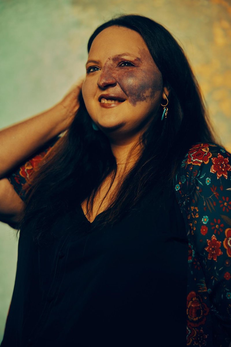 birthmarkwriter's tweet photo. Giving my very first TEDx talk on Friday. Feeling all the feelings, and enjoying the journey. https://t.co/MPCLfi8frV