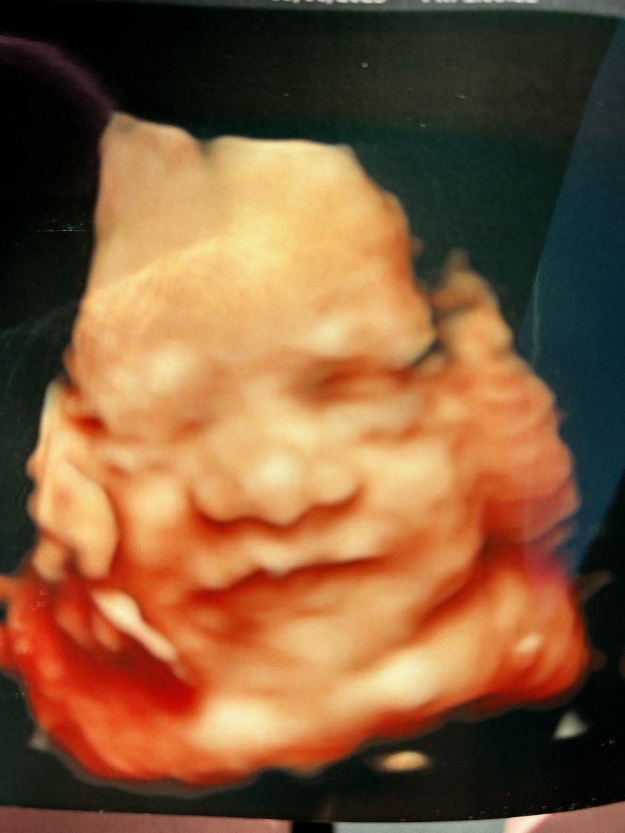 busymom1981's tweet photo. My heart is swelling with love. The newest little one smiled at Mommy and Daddy today. https://t.co/rhnX7W6EZA