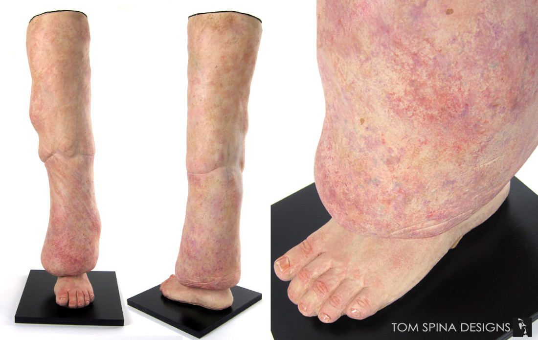 TomSpinaDesigns's tweet photo. Anatomically correct! https://t.co/7Lf0t8viy9

We can create all types of sculpture, including realistic models like this latex and foam leg representing Lymphedema. Contact us for your next medical project!

#TomSpinaDesigns #makeupeffects #models #medicalprops https://t.co/wzVgN1W64T