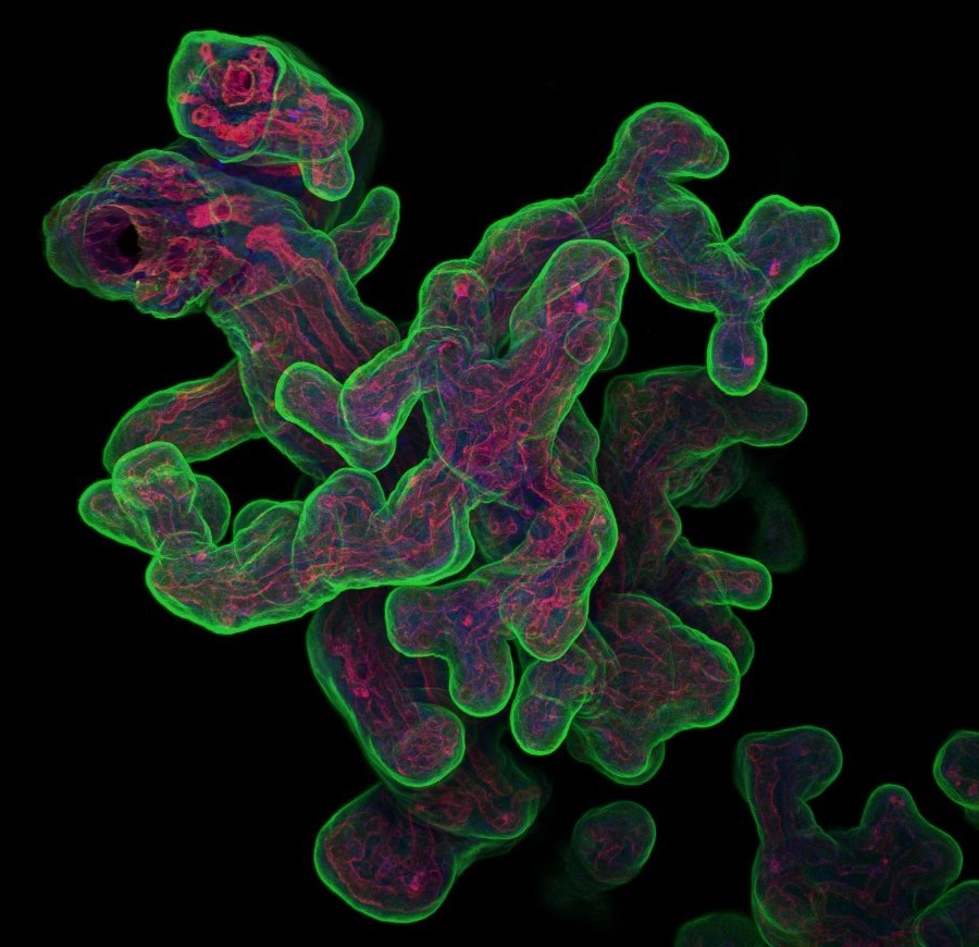 Calling all placental researchers in Europe! Join the European Placenta Group (EPG)  to connect with the European placental research community. Find out more on our website europeanplacenta.com