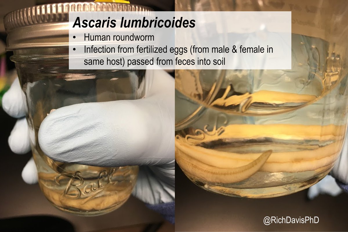 #MicroRounds (Day 994): 'jarring' Ascaris lumbricoides arrived to the lab in a handy Mason jar! These are found when coughed up or passed in stool. Close examination would show 3 'lips' and, if male, a curled tail. Spread by ingesting fertilized eggs from the soil #IDTwitter