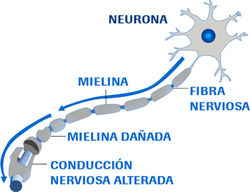 ConocelaEM's tweet photo. Si tienes #EsclerosisMúltiple, es posible que sepas que es una enfermedad autoinmune de origen inflamatorio 💡

La inflamación es una reacción del sistema inmune y te contamos cómo funciona y afecta al cuerpo 🦠

#InflamaciónEM

https://t.co/CxphdBBDLm https://t.co/J0siSnS30D