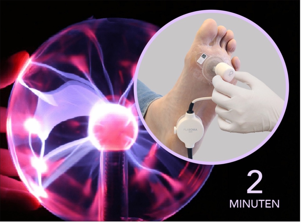 Plasmacure tweet media