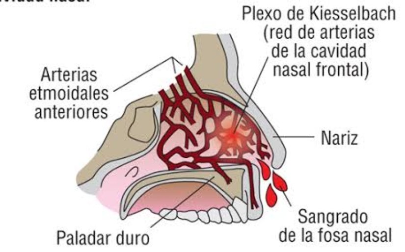 MoXtian's tweet photo. @jorge_suarez Uy mi George! Padezco ese problema desde que tengo memoria, es el plexo de Kiesselbach que se dilata fácilmente. A mi me ayudó hidratar las fosas con aceite de bebé y mantener el cuerpo hidratado. Por supuesto un taponcito de papel en el momento. https://t.co/tgb3V2nJ4h