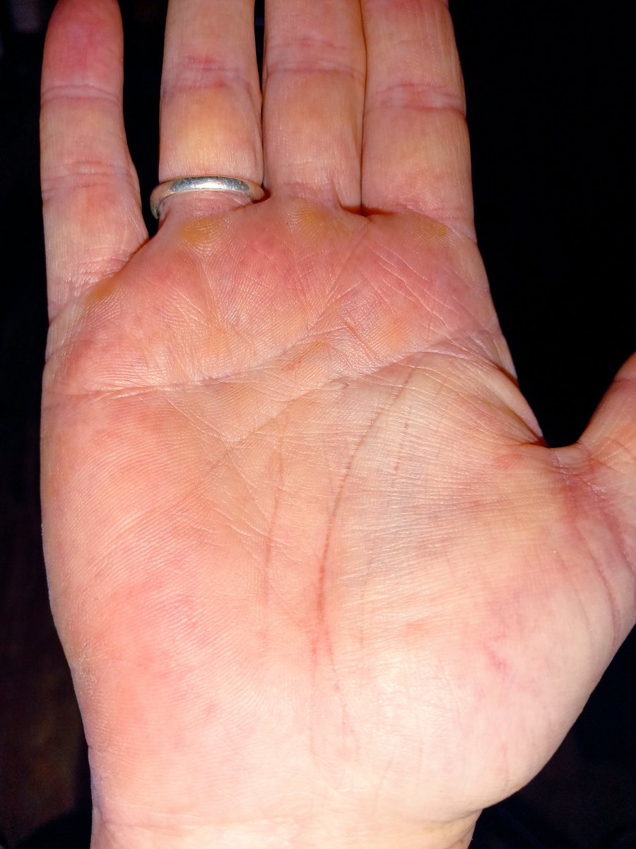 Can I get a free palm reading? Lol! JK! I am not really sure how those work. Yes, I have calluses...I work hard. 

#palm #palms #palmreader #palmreading #palmreadings #questions #curious #interested