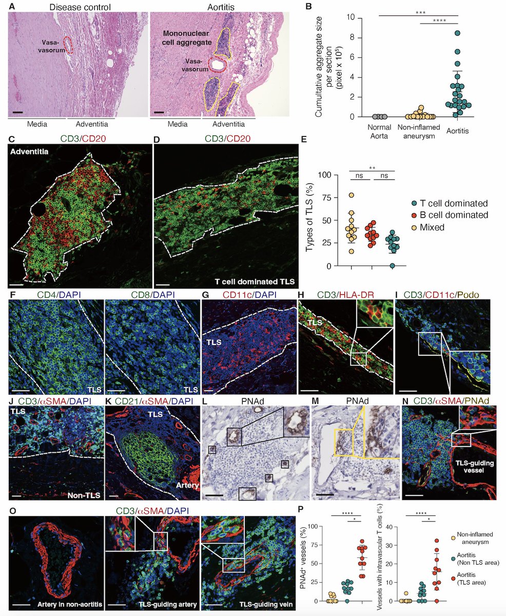 Abhinav Jain (@abhinav_jain_19) on Twitter photo Check out our recent article on Tertiary Lymphoid Structures (TLS) and autoimmunity published in <a href="/ScienceTM/">Science Translational Medicine</a> led by <a href="/YukiSat71808438/">Yuki Sato</a> in <a href="/MayoClinic/">Mayo Clinic</a> . I'm incredibly proud to have been a part of the team
science.org/doi/10.1126/sc…
#Immunology #CD4Tcells #TLS #WeyandLab #GoronzyLab Check out our recent article on Tertiary Lymphoid Structures (TLS) and autoimmunity published in <a href="/ScienceTM/">Science Translational Medicine</a> led by <a href="/YukiSat71808438/">Yuki Sato</a> in <a href="/MayoClinic/">Mayo Clinic</a> . I'm incredibly proud to have been a part of the team
science.org/doi/10.1126/sc…
#Immunology #CD4Tcells #TLS #WeyandLab #GoronzyLab