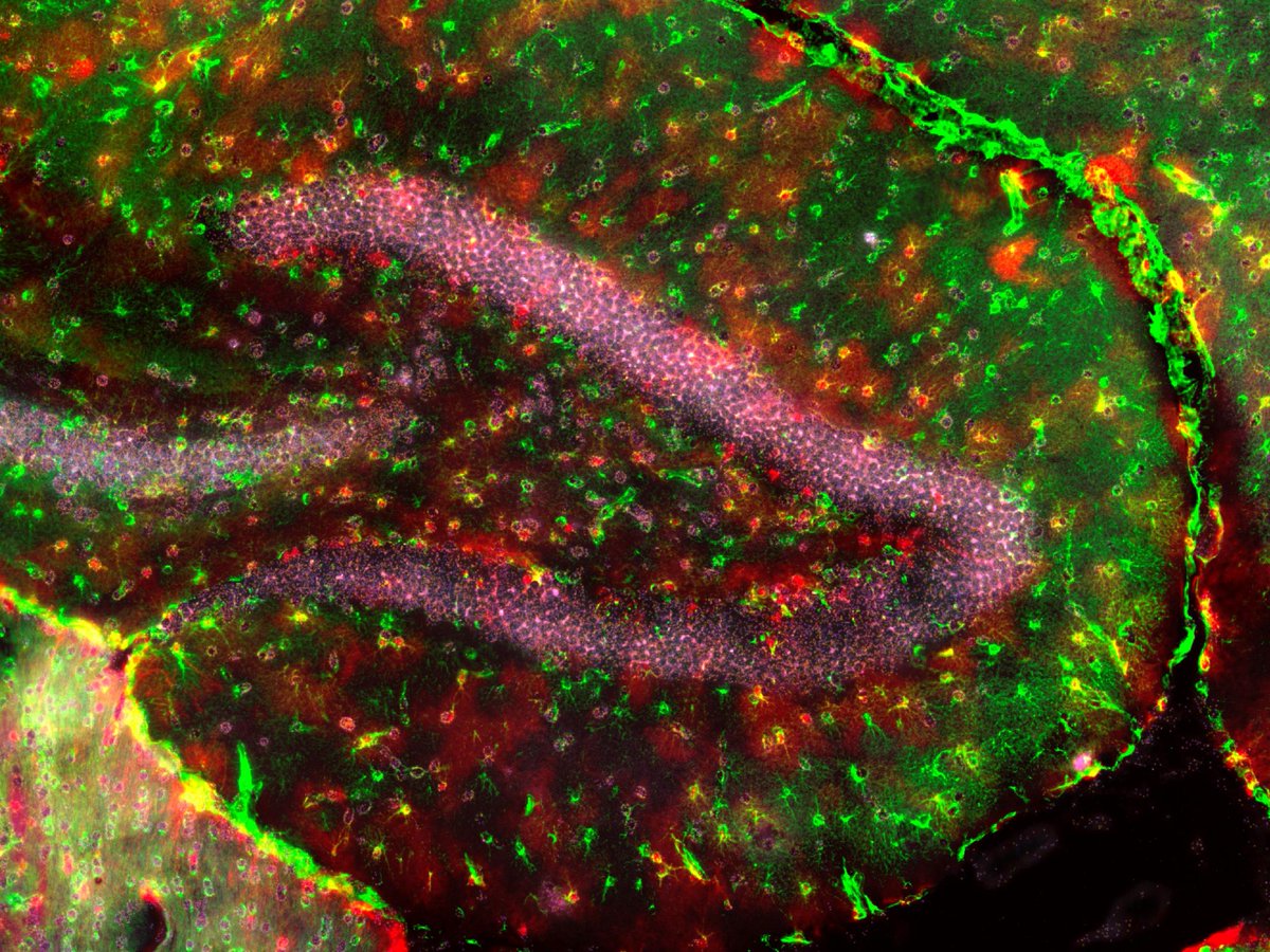 Faculté de biologie et de médecine (inactif) (@fbm_unil) on Twitter photo 📰News Recherche
La découverte de cellules d’un nouveau genre bouscule les neurosciences 🔬🧠 <a href="/Nature/">nature</a>
➡️news.unil.ch/display/169381…
<a href="/LudovicTelley/">Ludovic Telley</a> <a href="/Volterra_Lab/">Volterra_Lab</a> <a href="/DNF_neuro/">Department of Fundamental Neurosciences</a> <a href="/FBM_UNIL/">Faculté de biologie et de médecine (inactif)</a> <a href="/unil/">Université de Lausanne</a> <a href="/Wysscenter/">Wyss Center</a>
#nouvelles #cellules #cerveau
📷©Telley/Volterra, UNIL 📰News Recherche
La découverte de cellules d’un nouveau genre bouscule les neurosciences 🔬🧠 <a href="/Nature/">nature</a>
➡️news.unil.ch/display/169381…
<a href="/LudovicTelley/">Ludovic Telley</a> <a href="/Volterra_Lab/">Volterra_Lab</a> <a href="/DNF_neuro/">Department of Fundamental Neurosciences</a> <a href="/FBM_UNIL/">Faculté de biologie et de médecine (inactif)</a> <a href="/unil/">Université de Lausanne</a> <a href="/Wysscenter/">Wyss Center</a>
#nouvelles #cellules #cerveau
📷©Telley/Volterra, UNIL