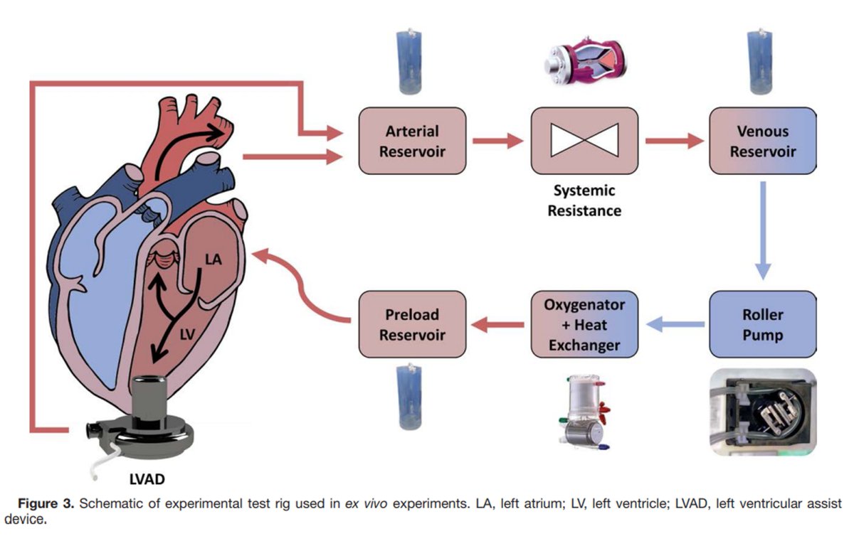 asaiojournal (@asaiojournal) on Twitter photo Read the September issue #FREE #EditorsPick
Estimation of Left Ventricular Stroke Work for Rotary Left Ventricular Assist Devices
ow.ly/uijT50PLFN5
<a href="/AndrewFStephens/">Andrew Stephens</a>
#LVAD #patientmonitoring #LVSW #stroke #AorticValve #HeartFailure Read the September issue #FREE #EditorsPick
Estimation of Left Ventricular Stroke Work for Rotary Left Ventricular Assist Devices
ow.ly/uijT50PLFN5
<a href="/AndrewFStephens/">Andrew Stephens</a>
#LVAD #patientmonitoring #LVSW #stroke #AorticValve #HeartFailure