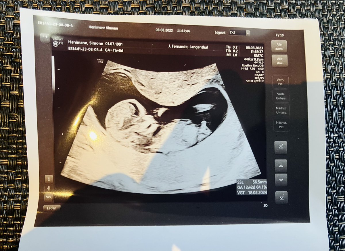 NickyRSwiss's tweet photo. Little @nickyromero fan incoming 🥰🙋‍♀️ @ProtocolRec https://t.co/33JT1YypZT