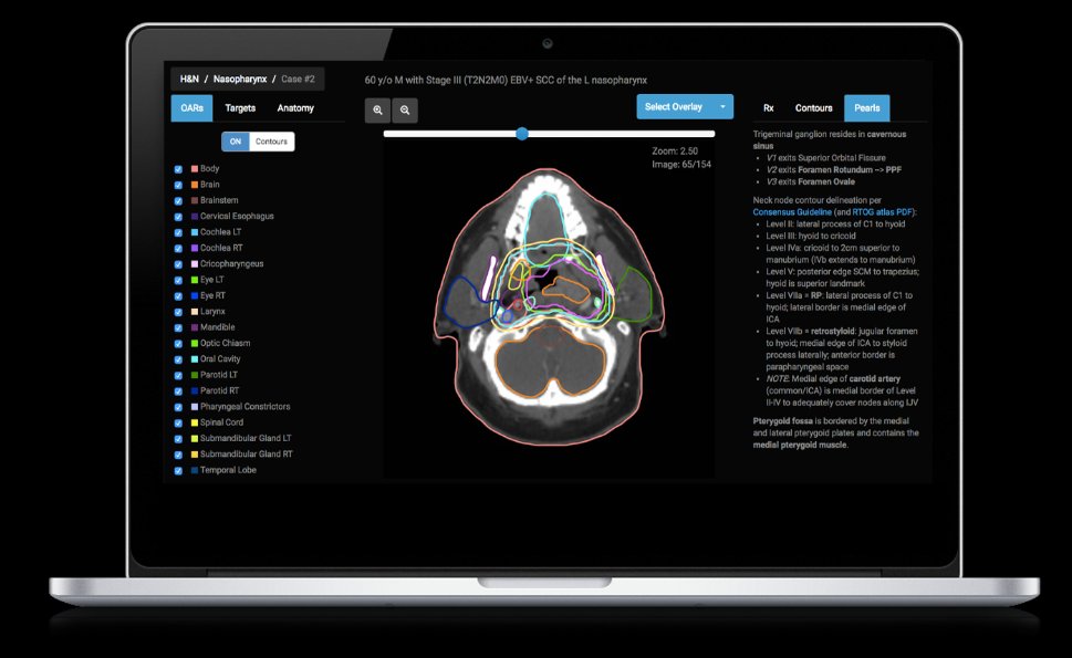 eContour (@econtourradonc) on Twitter photo If you love contouring (or even if you don't 😁), get your pencil & brush ready!! 🖊✏ 🖌
Our annual travel grant w <a href="/ACRORadOnc/">ACRO - American College of Radiation Oncology</a> <a href="/ACROresident/">ACROresident</a> & <a href="/mimsoftware/">MIM Software</a> is back!
Don't see a case you want on our website? Submit your proposal here 👇🏽
acro.org/page/annual-me… If you love contouring (or even if you don't 😁), get your pencil & brush ready!! 🖊✏ 🖌
Our annual travel grant w <a href="/ACRORadOnc/">ACRO - American College of Radiation Oncology</a> <a href="/ACROresident/">ACROresident</a> & <a href="/mimsoftware/">MIM Software</a> is back!
Don't see a case you want on our website? Submit your proposal here 👇🏽
acro.org/page/annual-me…