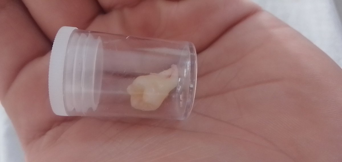 Día 388 en 🇧🇷
Primera y una vez que me saco una muela de juicio. Porque las otras 3 por suerte no van a nacer nunca más.