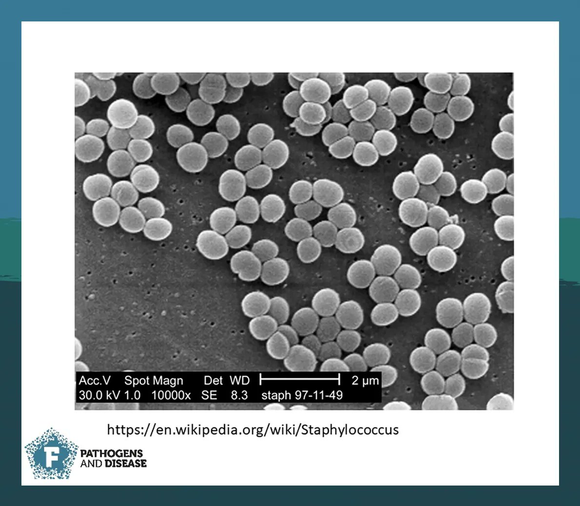 FEMSmicro's tweet photo. A timely minireview highlights the application of passive and active immunotherapies against drug resistant Staphylococcus aureus and pinpoints #biofilms as the major obstacle in anti-S. aureus #immunotherapy. Read the study in #PathogDis
https://t.co/12FtNWBc3J https://t.co/xkPk51nulQ