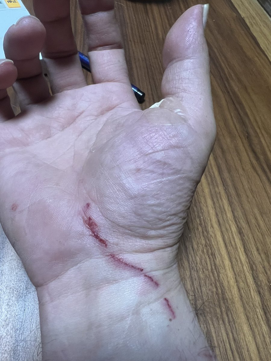 Macharucharu's tweet photo. 飼い猫ゲロ吐いてたのを後ろから捕まえたらびっくりしてやられた
すまんナツ子 https://t.co/9SyKPiMuf4