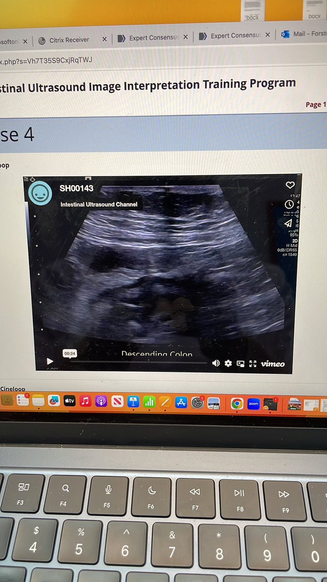 What a fantastic (near) end to 2 weeks in Copenhagen for #IUS with <a href="/RuneWilkens/">Rune Wilkens</a> <a href="/BMatro_IBDMD/">Becky Matro MD</a> is next #changinglivesoneptatatime 
THANK YOU!