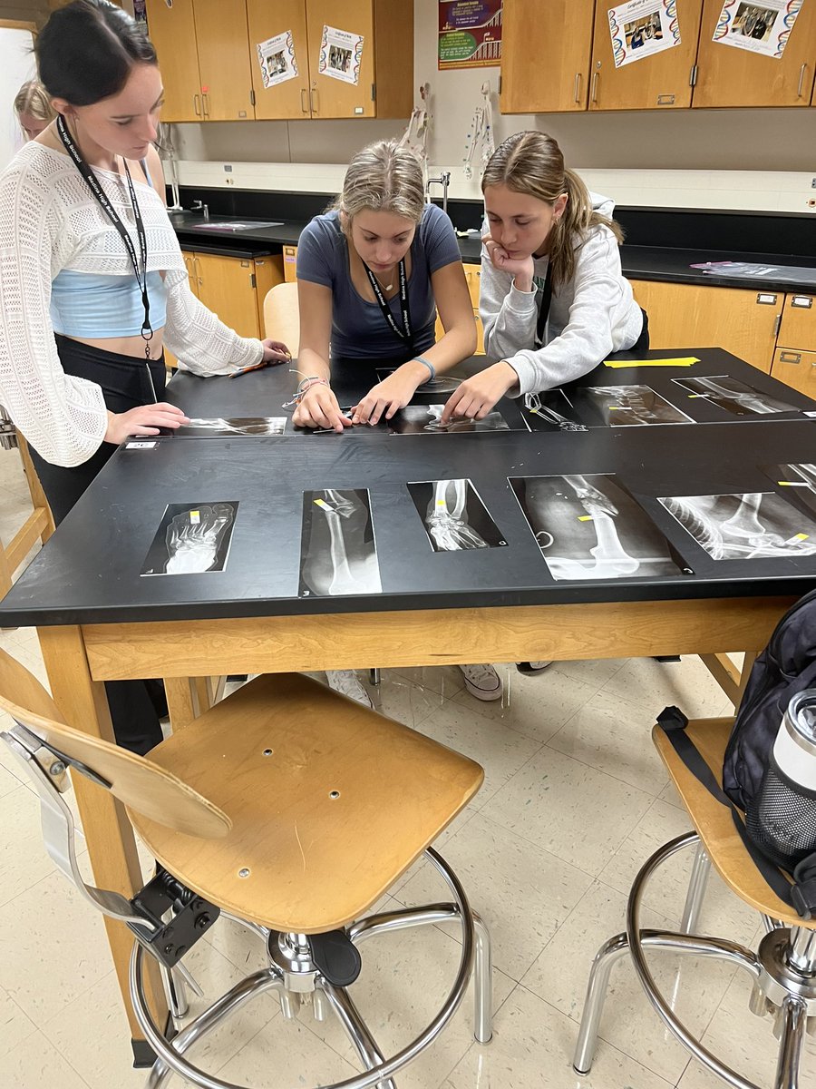 MrsMedlockMHS's tweet photo. HBS X-Ray Shuffle! 🩻 taking what we learned about the bones and reorganizing X-rays and their fractures! 

#PLTW #HBS #weRmedina #MCCCPLTW

PLTW is a collaboration between MCCC and MCS https://t.co/VVmEyU6alU