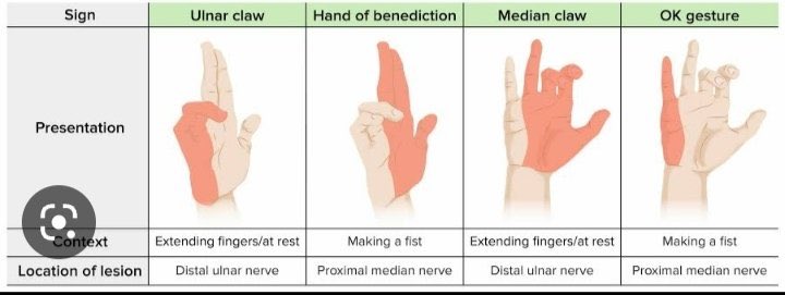 OGdukeneurosurg's tweet photo. Peripheral nerve injuries https://t.co/jGD13MNBSf