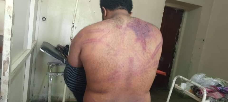 TghatMedia's tweet photo. Another activist, Zemas Tsigab, has been brutalized like this. 4/n https://t.co/c88y6tkdDo