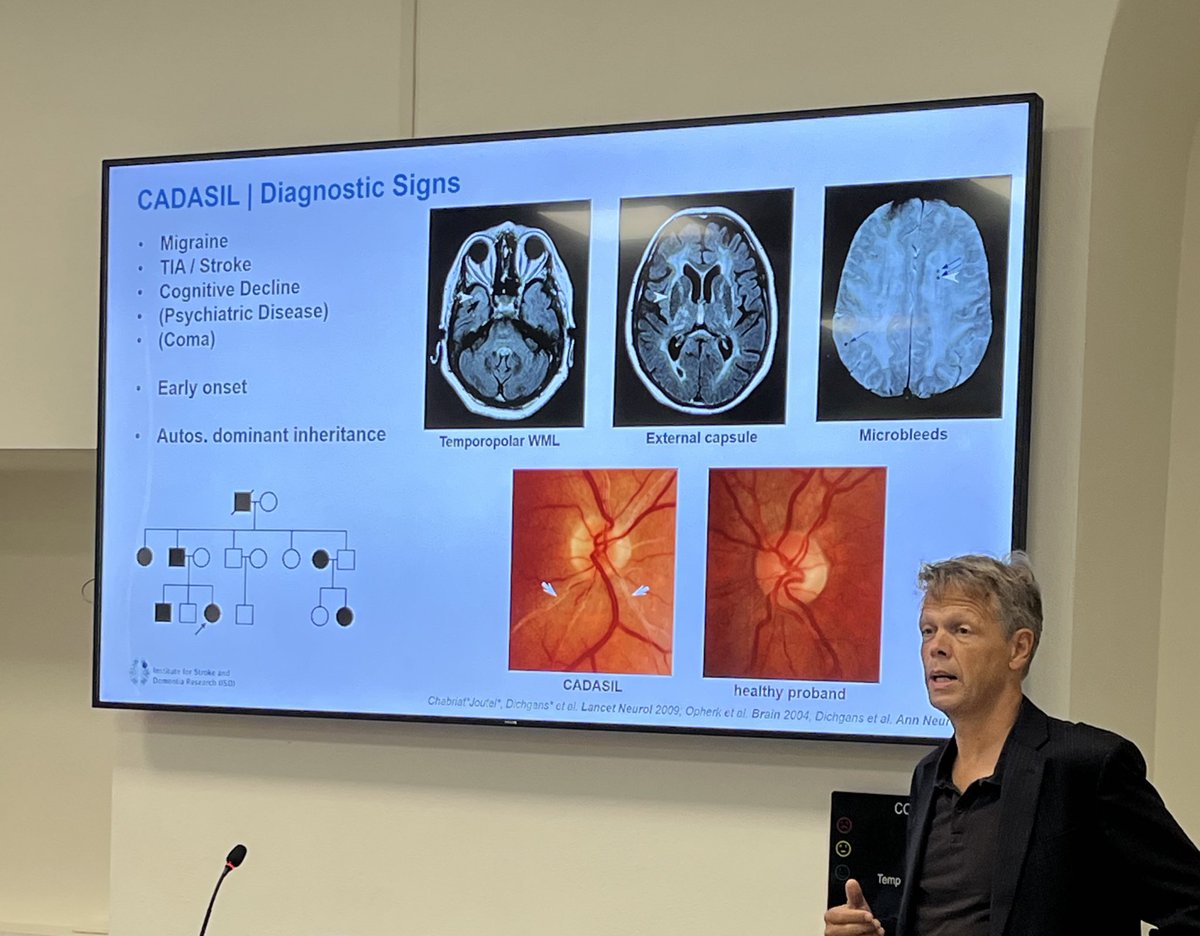 ESOstroke's tweet photo. „Learning from #genetics supports us in #strokeprevention and better classification of #diseases“ Martin Dichgans, @ISD_Research lecturing at #ESOsummerschool about #stroke and genetics. 

#StrokeEducation https://t.co/qyqVsZNwMu