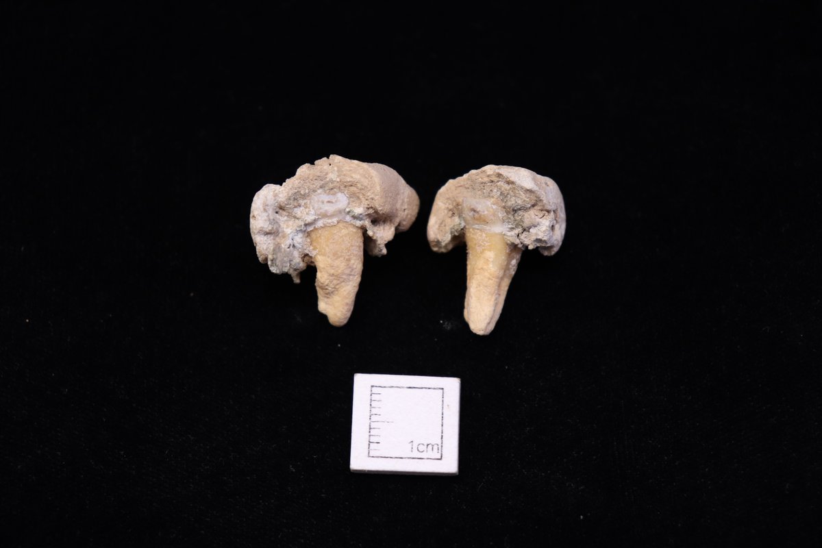 wessexarch's tweet photo. Exploring dental hygiene with this #FoundInTheGround discovery!
These teeth belonged to an Anglo-Saxon male in Bulford, Wiltshire, showing extreme dental calculus—the worst our osteoarchaeologists have seen. A glimpse into the challenges of the past. Cheers to modern dental care! https://t.co/YwWwE4xpQI