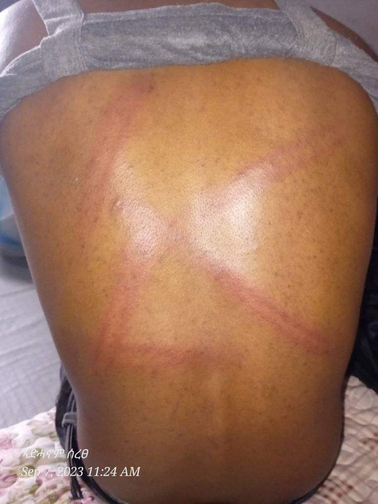 BrhaneNe's tweet photo. ክቐትሉዋ ዝመጹ ምሩዃት ትቕልብ ትግራይ ፣ ንስለኣ ህይወቶም በጅዮም ዝተቓለሱላ ብበትሪ ትቕጥቅጥ! 

ድምጺ ዜጋታት ብምዕፋን ዝቕጽል ስርዓት የለን። ውልቀ ምልክነት የብቅዕ! ሰላማውያን ሰባት ይፈትሑ!

@reda_getachew @ProfKindeya @hgodefay Shame on you! https://t.co/Y6GrAKNnNm
