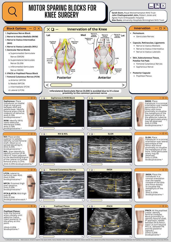 drsarahjanedunn's tweet photo. Fantastic talk at #ESRAworld2023 on knee RA today-thank you. @amit_pawa @docmorne. Do you like my infographic? #thisgirlblocks https://t.co/KzwbQeKSpg