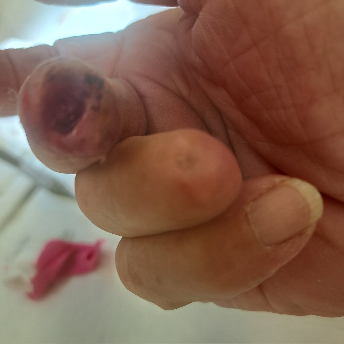 snepscheut3's tweet photo. @ZorinnaS 7 weeks ago my finger https://t.co/YplLfa8nXz