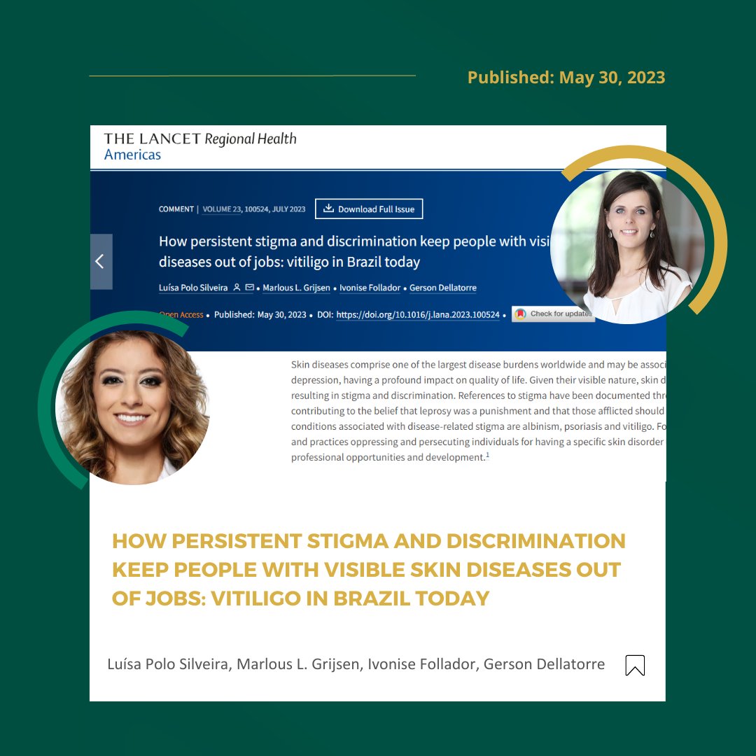 IFDerm's tweet photo. GLODERM Mentees @luisapolo0309 and @GrijsenMarlous from the GLODERM Mentorship Programme Class of 2022-2023 collaborated on an article to shed light on "How persistent stigma and discrimination keep people with visible skin diseases out of jobs: vitiligo in Brazil today". https://t.co/oCFXEPsKBL