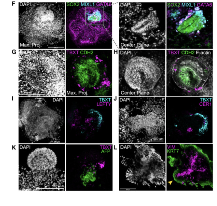 AMartinezArias's tweet photo. Interesting paper on extended #blastoid culture in @CellStemCell https://t.co/f4mDOPDntq….can’t see much related to #gastrulation. Where's the PrStre? Embryos do not come out of (and certainly are not) #scRNAseq data sets. We need to sort out what we call what
#NotaModel https://t.co/8a8HXM18Lk