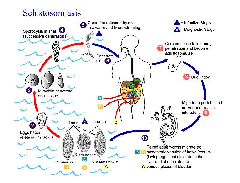 WillyFogPath's tweet image. Esquistosomiasis rectal👀:
🔸️Caso: ♂️ rectorragia. Colonoscopia➡️ pólipo rectal.
🔸️Agente: Schistosoma (🪱). 3 especies patológicas. 
🔸️Contagio contacto agua contaminada💧.
🔸️🔬:huevos🥚calcificados+ parásitos +eosinófilos.
🔸️Tto: 💊Praziquantel.
#GIPath #IDPath