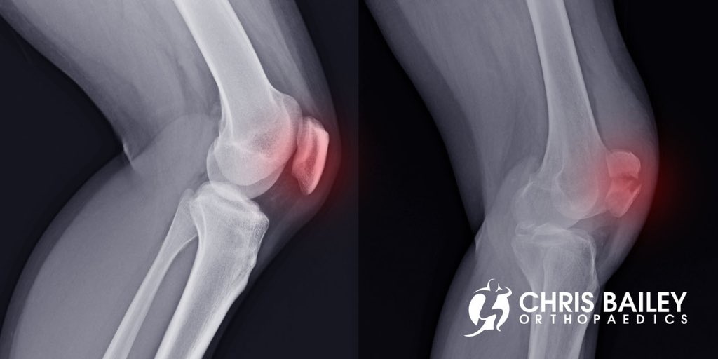 Tim Murray tweet media