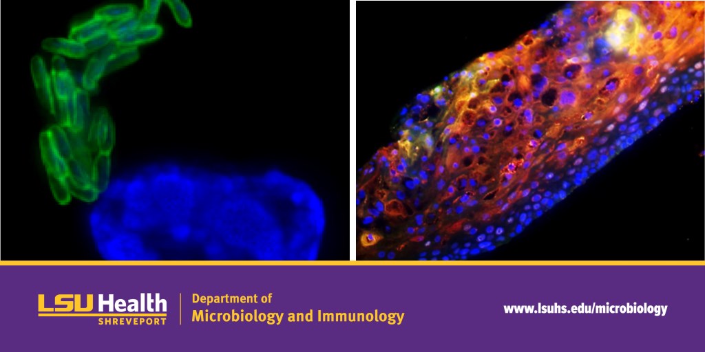 LSU Health Shreveport Microbiology and Immunology (@lsuhs_micro) on Twitter photo Interested in a PhD in microbiology and immunology?
<a href="/LSUHS_Micro/">LSU Health Shreveport Microbiology and Immunology</a> is officially recruited for Fall 2024!
Check us out at lsuhs.edu/microbiology!
Apply here - gradcas2024.liaisoncas.com/applicant-ux/#… Interested in a PhD in microbiology and immunology?
<a href="/LSUHS_Micro/">LSU Health Shreveport Microbiology and Immunology</a> is officially recruited for Fall 2024!
Check us out at lsuhs.edu/microbiology!
Apply here - gradcas2024.liaisoncas.com/applicant-ux/#…