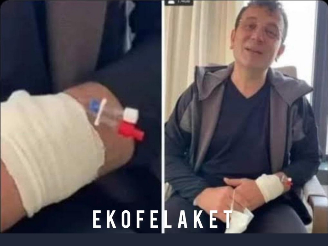 TrakyaARSLANI's tweet photo. Başkanın damar yolunu bizim terzi ŞÜKRÜ mü açmış:)
#iETTşoförleriperişan EkoFelaket https://t.co/8OVbVyo6As