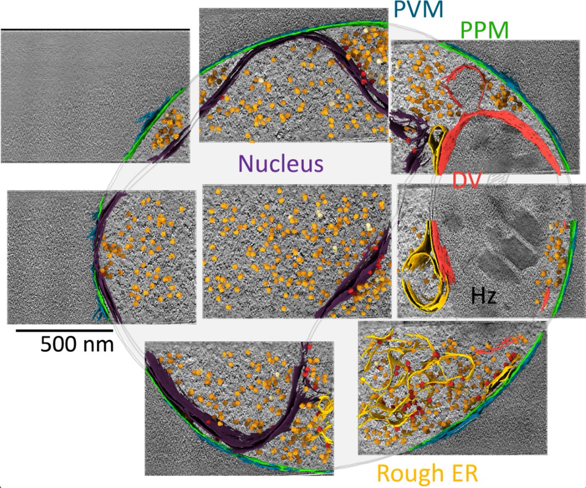 FitzpatrickLab's tweet photo. Groundbreaking study from @mimi1inh and all members of @cmholab combining in situ #cryoET and #proteomics to determine the antimalarial activity of inhibiting translation in #cryoFIB-milled #malaria parasites:
https://t.co/gBw6TNAdKP
#cryoEM #massspec #teamtomo #modeofaction https://t.co/z4IG3VxmG2