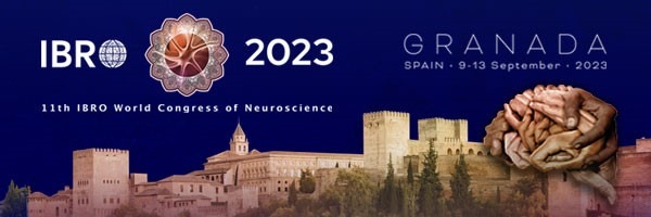 mightexsystems's tweet photo. 🌟Join us at #IBRO2023 in Granada, Spain 🇪🇸 from Sep 9-13. Dr. Catherine Thomas will present on ''A novel data analysis pipeline for fiber-based in vivo calcium imaging''.   

Meet us at Booth No: 2.  

More info➡️ https://t.co/pKzz9k9jQX

#Neuroscience #OASISimplant #Mightex https://t.co/6gqU1lsIMS