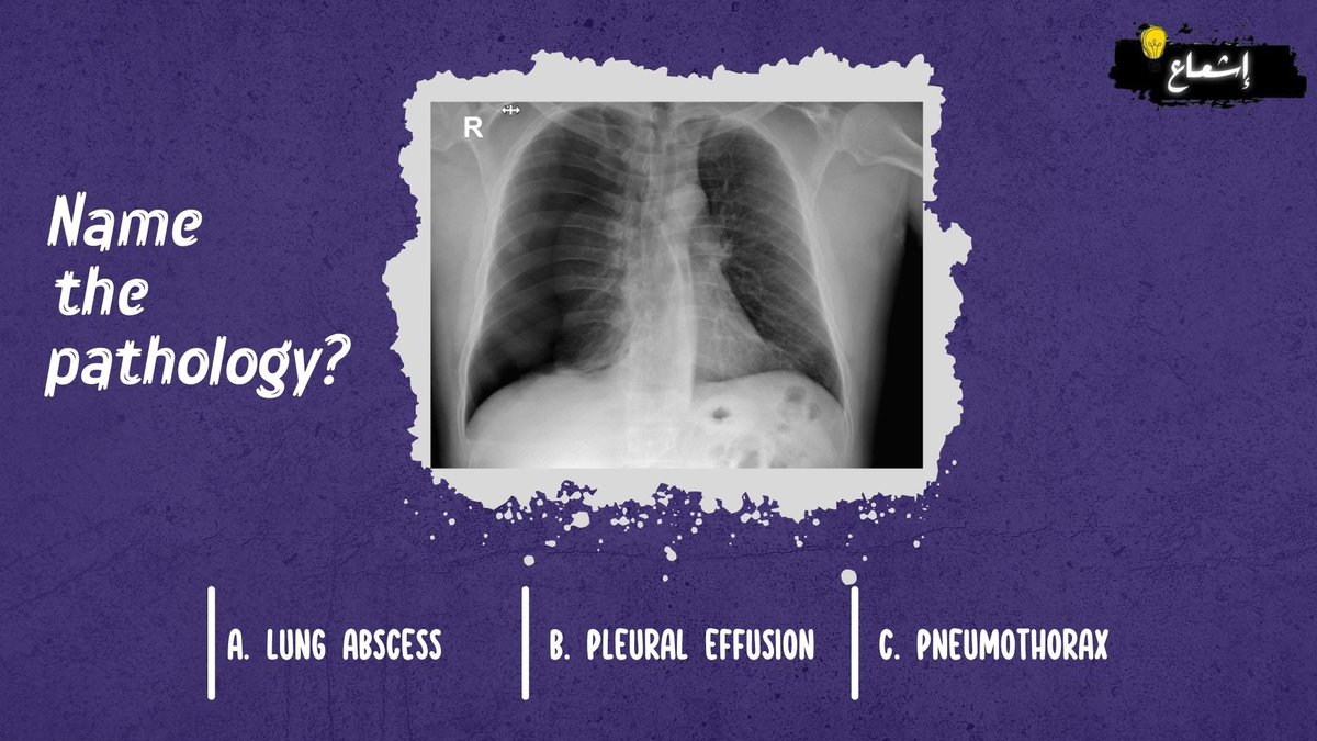 MedProjection's tweet image. 🤔🩻?