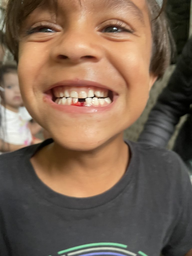 Meu filho acabou de perde o primeiro dentinho 🦷 ❤️