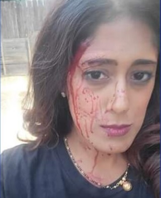EmmaRincon's tweet photo. 🇺🇸 Ella es Shivanthi Sathanandan, la progresista segunda vicepresidente del Partido Demócrata en Minnesota, ella abogó durante años por el desmantelamiento del Departamento de Policía de Minneapolis, incluso cuando los barrios de la ciudad fueron quemados por miembros de Black Lives Matters y ANTIFA. 

Lamentablemente ahora ha denunciado que fue víctima de un violento robo de su vehículo frente a su casa. Unos jóvenes armados la golpearon delante de sus hijos. Ahora pide que se procese a sus agresores y que se "recupere" la ciudad.

En 2020 había publicado en Facebook: "Vamos a desmantelar el Departamento de Policía de Minneapolis... Si todavía estás en desacuerdo con ese HECHO BÁSICO, no estoy seguro de qué decirte".

De alguna forma, los progresistas están cosechando lo que han impulsado con sus políticas. Lástima que esta sea la forma en que despierten: