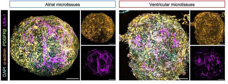 Organoid News (@organoidscience) on Twitter photo Are you fascinated by cardiac #organoids? 🤩
If yes, then you might want to check out this <a href="/FrontCVMedicine/">Frontiers in Cardiovascular Medicine</a> article by Drs. Jasmeet Singh (<a href="/SikhScientist/">Jasmeet Singh</a>), Abdullah Khan (<a href="/AbAttacks/">Abdullah Khan</a>), and colleagues at @ICVS_UoB! Are you fascinated by cardiac #organoids? 🤩
If yes, then you might want to check out this <a href="/FrontCVMedicine/">Frontiers in Cardiovascular Medicine</a> article by Drs. Jasmeet Singh (<a href="/SikhScientist/">Jasmeet Singh</a>), Abdullah Khan (<a href="/AbAttacks/">Abdullah Khan</a>), and colleagues at @ICVS_UoB!