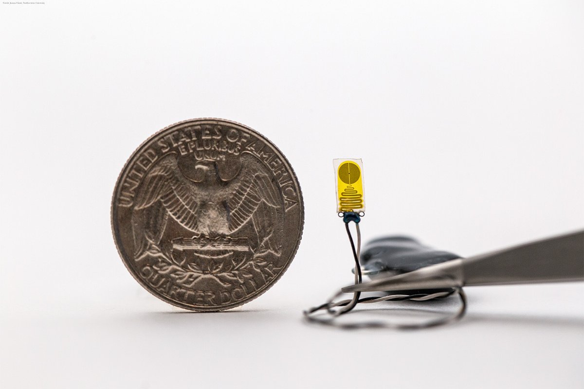 ScienceMagazine's tweet photo. An implantable sensor provided advanced warning of kidney transplant failure in rats as much as several weeks earlier than commonly used biomarkers of kidney function, researchers report in Science.

Learn more: https://t.co/W4ksqyabXk https://t.co/ylowLITVcF