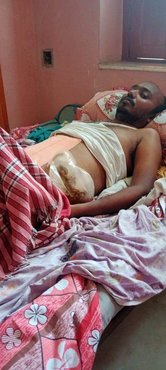 BSNLwarriors123's tweet photo. कितना शर्म का बात है BSNL JE से मजदूरी कर रहा है। Atleast BSNL should provide splicer on contract to Tx &amp; CNTx section. JE को splicing के लिए नही रिक्रूट किया गया है। Field allowances bhi only Rs. 125/- JE level pe.
Pls take action
@aigetoachq @sneachq @NFTE_BR @BSNL_BR @CMDBSNL https://t.co/CtJaVw9qpk