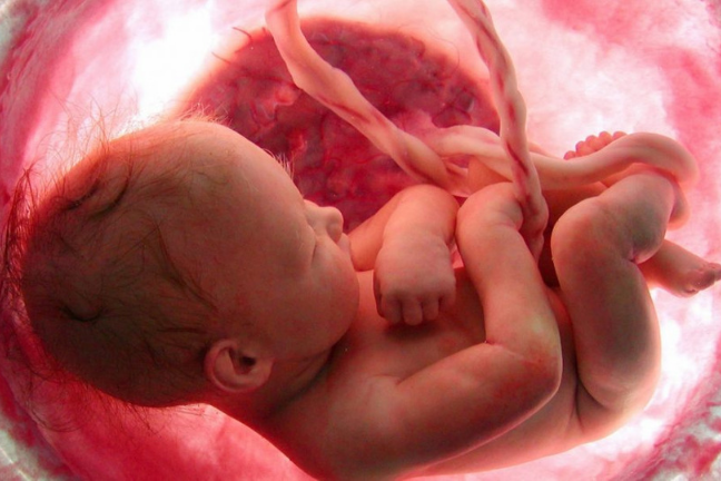 LifeNewsHQ's tweet photo. BREAKING: Texas Has Just 17 Abortions in 2023, Abortion Ban Saves Tens of Thousands of Babies https://t.co/LArpY3yxGO https://t.co/Tm6lf31MmX