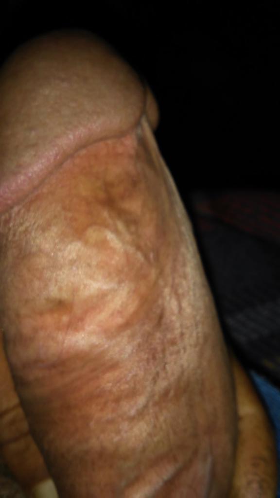 مخزن وزبي متشنجه عروقه محروم مكتظ صيب وين الطيز المشتهي اروي عطشه يمص حليب ويشرب مليان وينحني علا ركبتيه  أدخل زبي كله لما يحسه في بطنه واشتغل فتحته نيك لما اظرطه وافضي داخلها وارهقه لذة وعراب يجنن جحره لذه ومتعة  .. 🔥

يجي يكلمني خاص😉🚶