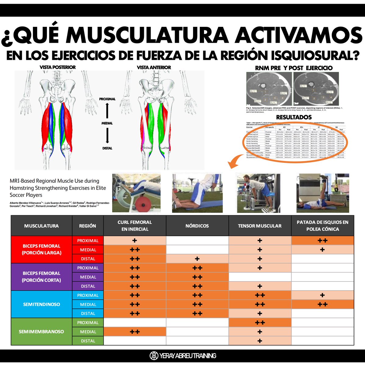 📊Excéntrico para isquios, ¿sabes qué ejercicio elegir para cada región?