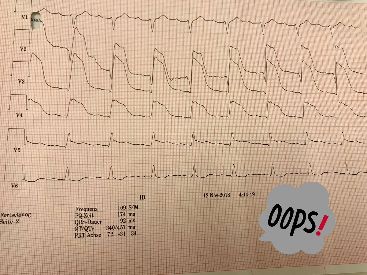 patyarrua's tweet photo. @CardioAPFerrol 💔 https://t.co/egCb1bqTW0