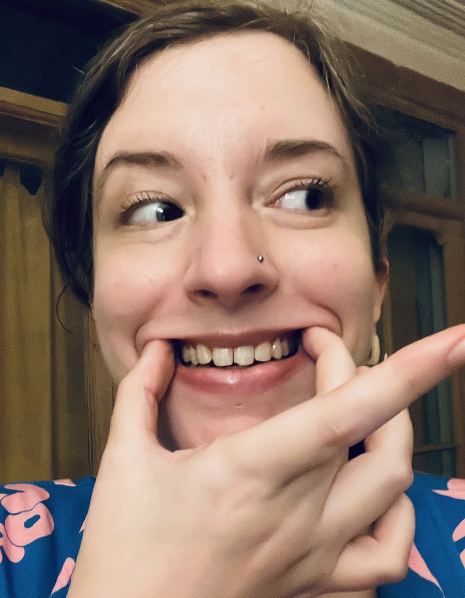 And my teeth are done!! 90 minutes, no needles, minimal discomfort. I’m so glad my mum told me about dental composite, I’d never have gone for veneers just for two teeth but I was so self conscious of my gappy smile before! #dentalwork #teeth #missingteeth #disabledandcute