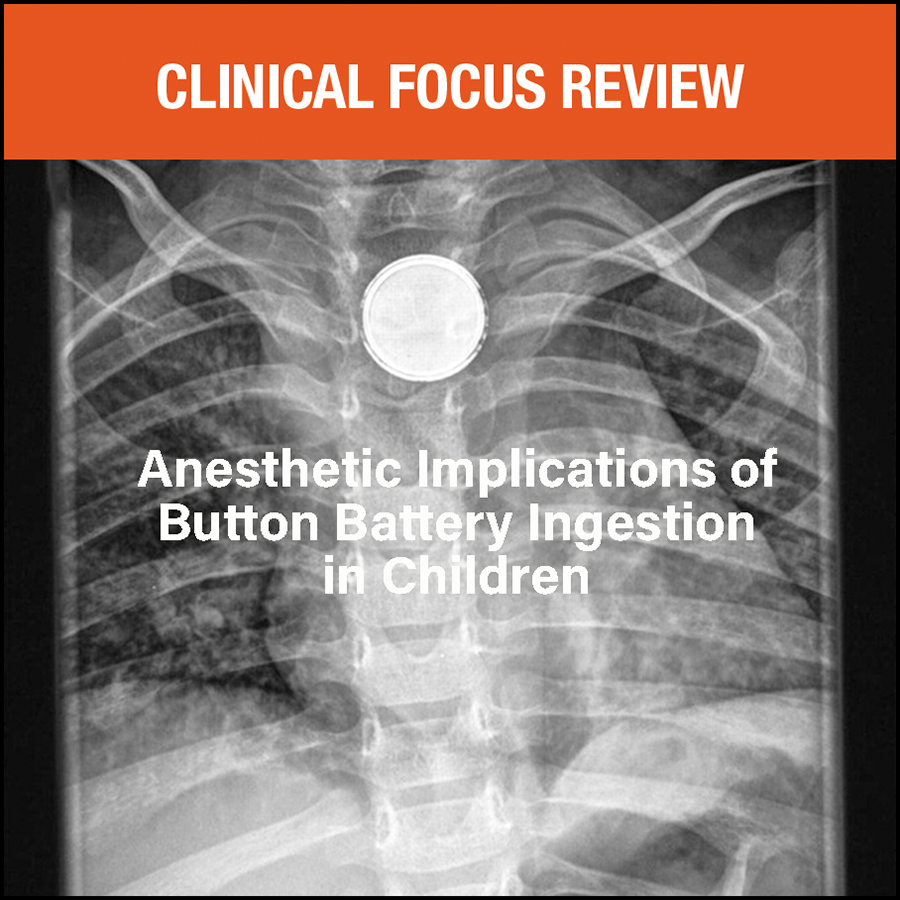 Button battery ingestion in children has been associated with significant morbidity and mortality. Authors review the mechanisms of injury, potential complications, mitigation strategies, and the underlying urgent need for battery removal: ow.ly/tWIL50PIweq